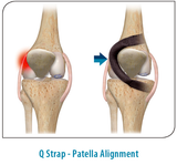 OA Spiral™ Kniebandage
